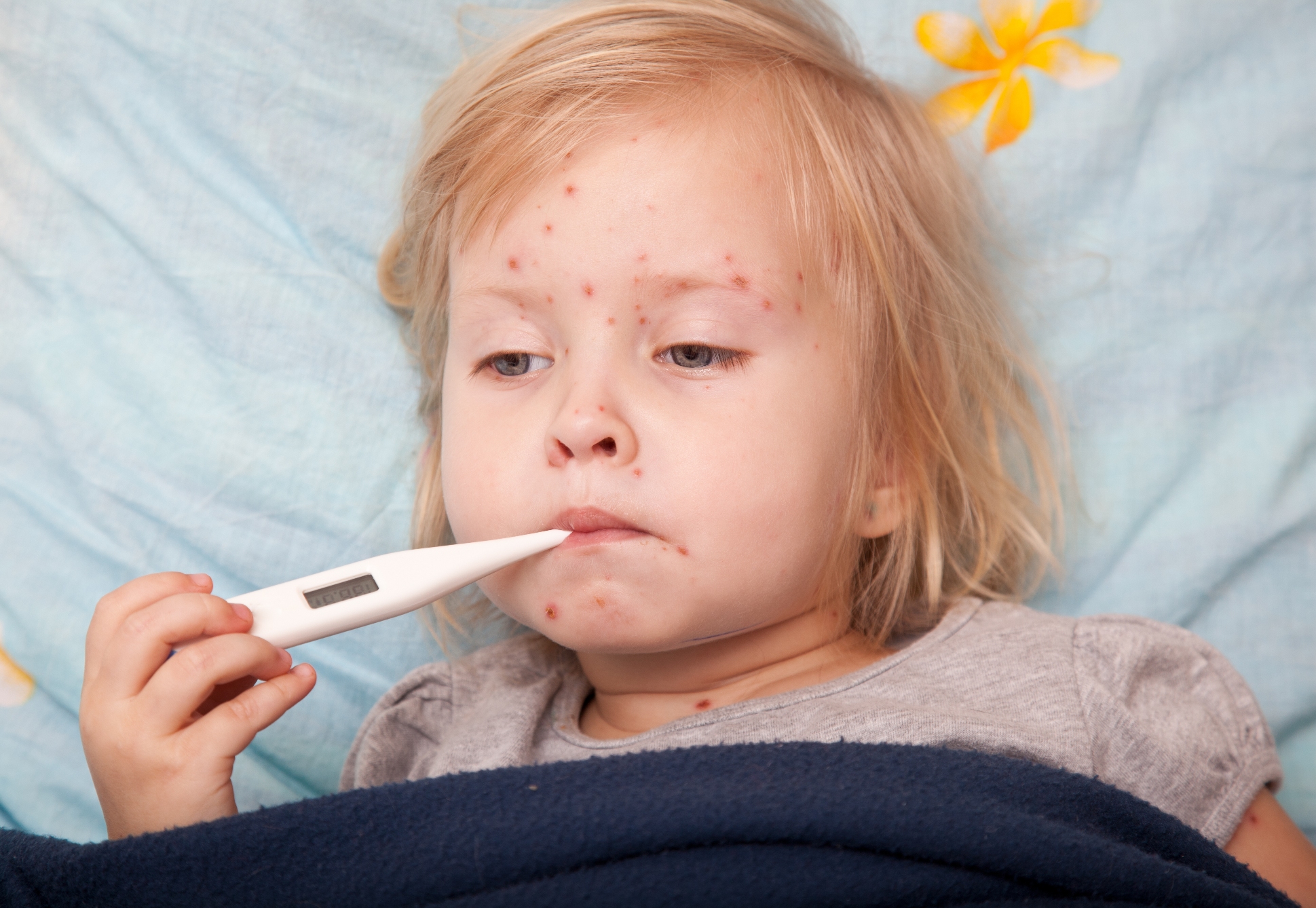 Các bệnh thường gặp ở trẻ nhỏ mùa nắng nóng