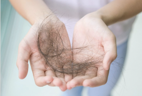 Cách ngăn ngừa chứng rụng tóc -0