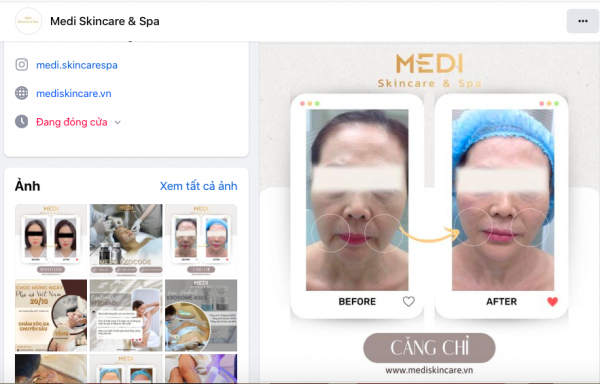 TP. Hồ Chí Minh: Medi Skin Care & Spa chưa có giấy phép hoạt động khám chữa bệnh