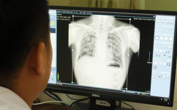Vụ 6 công nhân tử vong do bụi phổi tại Nghệ An: Chủ doanh nghiệp chi hơn nửa tỷ đồng bồi thường -0
