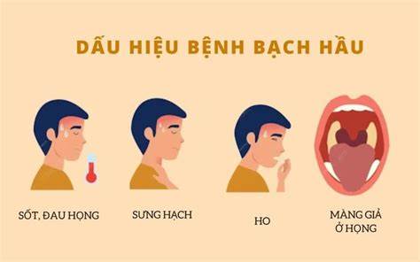 Cần phân biệt bệnh bạch hầu với các bệnh đường hô hấp thông thường như thế nào cho đúng? -0